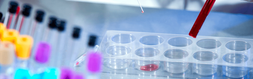 Hematologija
